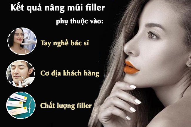 Nâng mũi filler giá bao nhiêu tại thẩm mỹ vip Tiem-filler-mui-co-tot-khong